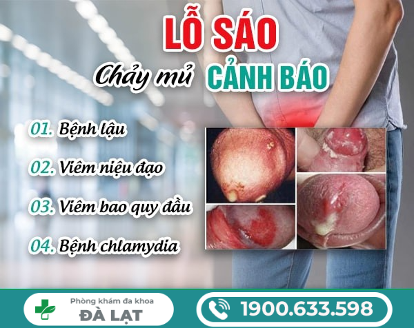 Hình ảnh minh họa